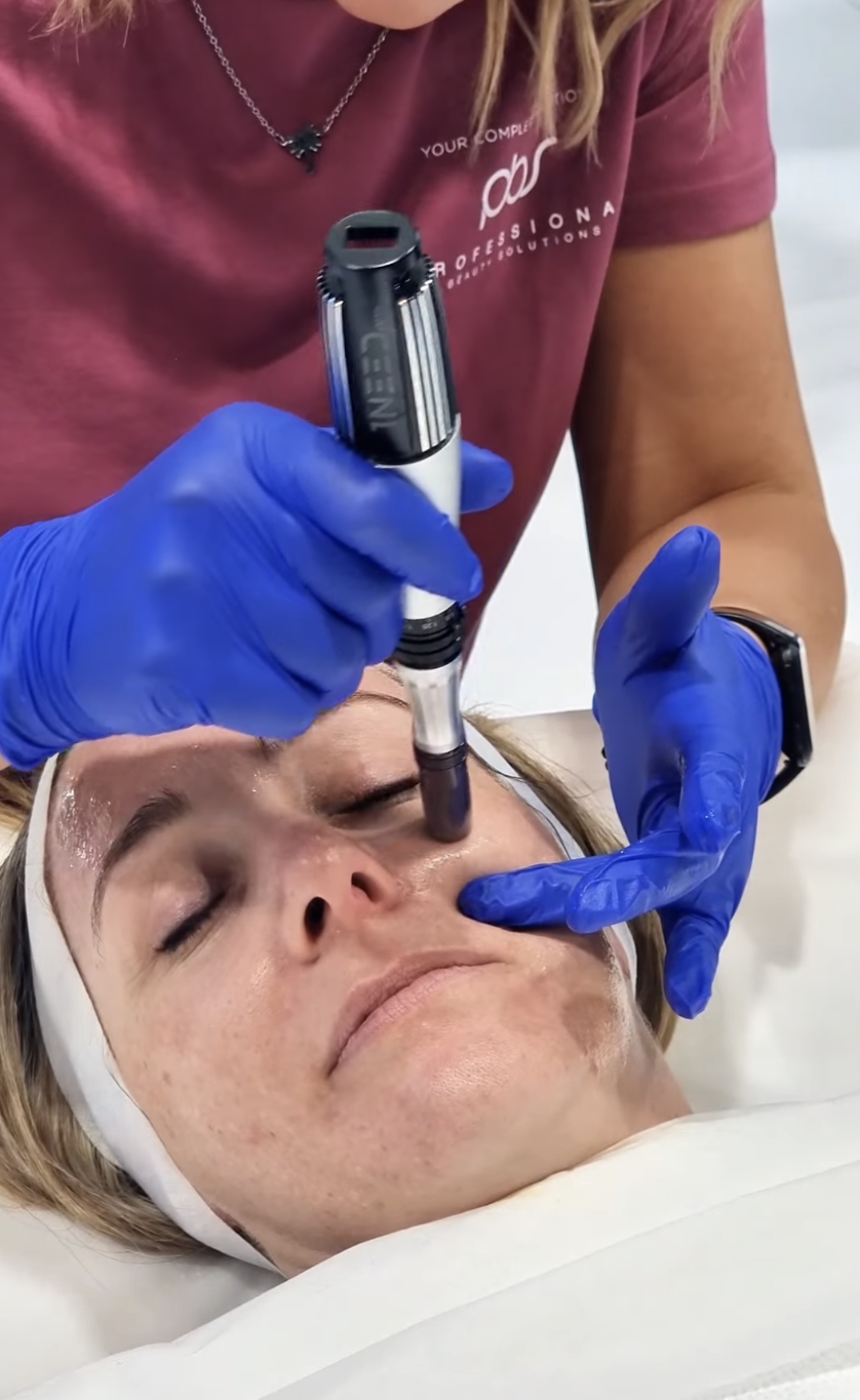 Microneedling treatment at Skinfit